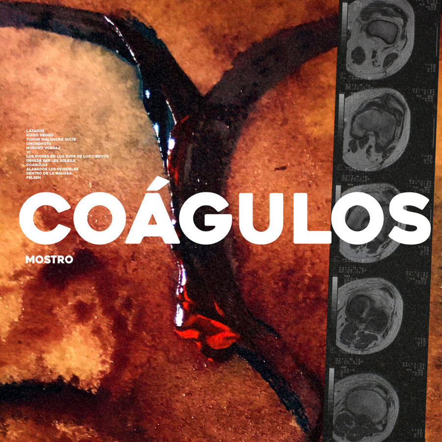 MOSTRO – COÁGULOS